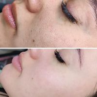اخرین جایی ک برای پوستت میری اینجاست|خدمات آرایشگری و زیبایی|تهران, قلهک|دیوار