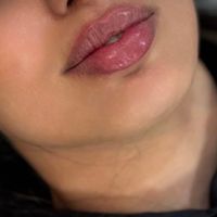 انجام خدمات زیبایی ژل و بوتاکس در کلینیک|خدمات آرایشگری و زیبایی|اصفهان, وحید|دیوار
