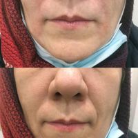 خدمات درمانی و زیبایی|خدمات آرایشگری و زیبایی|تهران, دروس|دیوار