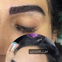 کاشت ابرو طبیعی و حرفه ای در کلینیک معتبر|خدمات آرایشگری و زیبایی|تهران, سهروردی|دیوار