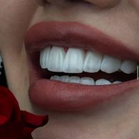 کامپوزیت دندان / طرح لبخند /با ضمانت کتبی|خدمات آرایشگری و زیبایی|تهران, نارمک|دیوار