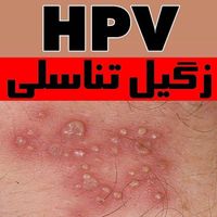 درمان زگیل تناسلی/ مشاوره Hpv|آرایشی، بهداشتی، درمانی|تهران, فرمانیه|دیوار