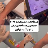 مطب خدمات لیزر موهای زائد الکساندرایت گراویتی2024|خدمات آرایشگری و زیبایی|تهران, نیاوران|دیوار