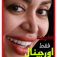 لمینیت کامپوزیت بریج و دندان مصنوعی و روکش|خدمات آرایشگری و زیبایی|تهران, آرژانتین|دیوار