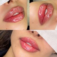 آموزش ژل و بوتاکس. لیفت صورت بانخ (کلینیک)|خدمات آرایشگری و زیبایی|بندرعباس, |دیوار
