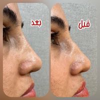 لیزر موهای زائد،ژل و بوتاکس و فیشال|خدمات آرایشگری و زیبایی|تهران, صد دستگاه|دیوار