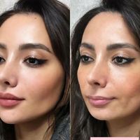 مطب پوست و مو و زیبایی|خدمات آرایشگری و زیبایی|تهران, سعادت‌آباد|دیوار