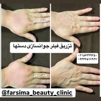 کلینیک پوست، مو و زیبایی فرسیما|خدمات آرایشگری و زیبایی|اسلام‌شهر, |دیوار