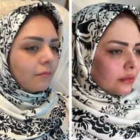 جشنواره  تزریق چربی لیزر لاغری ژل بوتاکس|خدمات آرایشگری و زیبایی|تهران, هفت حوض|دیوار