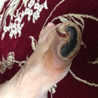 درمان زخم دیابت و زخم بستر سوختگی و عفونی|خدمات آرایشگری و زیبایی|کرج, باغستان|دیوار