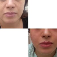 لیزر وخدمات درمانی پوست مو با بهترین کیفیت در جردن|خدمات آرایشگری و زیبایی|تهران, جردن|دیوار