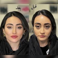 مطب پوست و مو و زیبایی|خدمات آرایشگری و زیبایی|تهران, سعادت‌آباد|دیوار