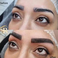 میکروبلیدینگ ابرو،فیبروز ابرو،شیدینگ لب،رژلب دائم|خدمات آرایشگری و زیبایی|تهران, تهران‌سر|دیوار