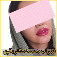 ژل لب بوتاکس فیلر لیزر موهای زائد|خدمات آرایشگری و زیبایی|تهران, پیروزی|دیوار