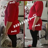 کوره چربیسوز|آرایشی، بهداشتی، درمانی|تهران, آرژانتین|دیوار