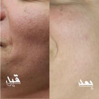 کاشت ناخن لیفت ابرو فیبروز مژه رنگ کراتین|خدمات آرایشگری و زیبایی|تهران, آذربایجان|دیوار