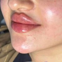 ** جشنواره تخفیفات بهاره تا خرداد *دکتر ابدال*|خدمات آرایشگری و زیبایی|اصفهان, ملک‌شهر|دیوار
