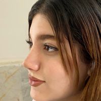 تخفیف عمل جراحی بینی فقط ۲۵ میلیون،بدون تامپون|خدمات آرایشگری و زیبایی|تهران, یوسف‌آباد|دیوار