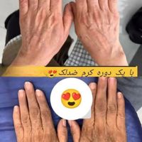 کرم ۸ کاره تضمینی|آرایشی، بهداشتی، درمانی|بندر امام خمینی, |دیوار