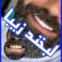 ایمپلنت عصبکشی روکش کامپوزیت ترمیم پوسیدگی دندان|خدمات آرایشگری و زیبایی|تهران, میدان ولیعصر|دیوار