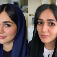 مطب پوست و مو و زیبایی|خدمات آرایشگری و زیبایی|تهران, سعادت‌آباد|دیوار