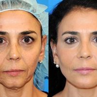 خدمات درمانی و زیبایی|خدمات آرایشگری و زیبایی|تهران, دروس|دیوار
