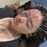 حجامت بادکش  طب سوزنی|خدمات آرایشگری و زیبایی|کرج, بهار|دیوار