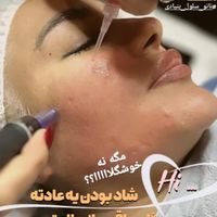 کیلینیک زیبایی روشا.افر یلدایی دهم دیماه|خدمات آرایشگری و زیبایی|تهران, پونک|دیوار