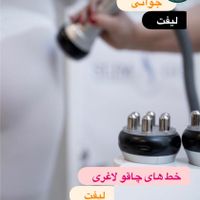 زیبای کلاژن لیفت لاغری هایفو|خدمات آرایشگری و زیبایی|تهران, سعادت‌آباد|دیوار