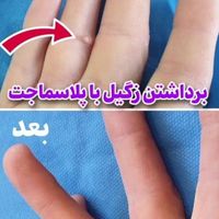 مدل لاغری بدون دستگاه و بدون عوارض‌|استخدام درمانی، زیبایی، بهداشتی|شیراز, قدوسی غربی|دیوار