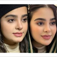 بوتکس،فیلر لب،ساکشن غبغب|خدمات آرایشگری و زیبایی|قدس, |دیوار