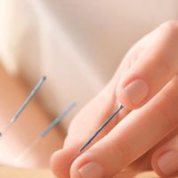 حجامت بادکش  طب سوزنی|خدمات آرایشگری و زیبایی|کرج, بهار|دیوار