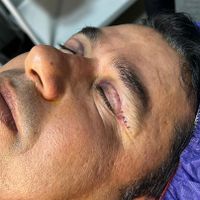 مرکز تخصصی بلفاروپلاستی|خدمات آرایشگری و زیبایی|تهران, سازمان برنامه|دیوار