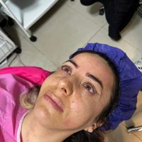 مرکز تخصصی بلفاروپلاستی|خدمات آرایشگری و زیبایی|تهران, سازمان برنامه|دیوار