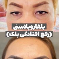 کلینیک زیبایی، کاشت ابرو،فیلر، فیشیال،کیمیااکسیر|خدمات آرایشگری و زیبایی|تهران, تهرانپارس غربی|دیوار