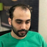 ترمیم مو به سبک مدرن،پروتز مو|آرایشی، بهداشتی، درمانی|تهران, نیاوران|دیوار