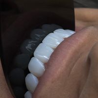 دندانپزشکی قیمت مناسب با کیفیت بالا|خدمات آرایشگری و زیبایی|تهران, تهرانپارس غربی|دیوار