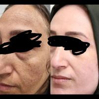 فروش تعداد زیادی حلزون|خزنده|تهران, تهرانپارس شرقی|دیوار