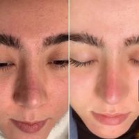 اخرین جایی ک برای پوستت میری اینجاست|خدمات آرایشگری و زیبایی|تهران, قلهک|دیوار