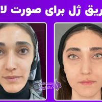 خدمات درمانی و زیبایی|خدمات آرایشگری و زیبایی|تهران, دروس|دیوار