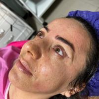 مرکز تخصصی بلفاروپلاستی|خدمات آرایشگری و زیبایی|تهران, سازمان برنامه|دیوار