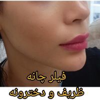 لیزر وخدمات درمانی پوست مو با بهترین کیفیت در جردن|خدمات آرایشگری و زیبایی|تهران, جردن|دیوار