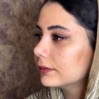 تخفیف عمل جراحی بینی فقط ۲۵ میلیون،بدون تامپون|خدمات آرایشگری و زیبایی|تهران, یوسف‌آباد|دیوار