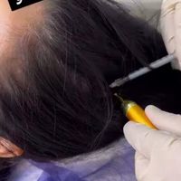 ژل بوتاکس لیزر مزو پی آر پی خالیرداری جوانسازی|خدمات آرایشگری و زیبایی|تهران, افسریه|دیوار