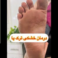 پدیکور پا (کف سابی) آقایان|خدمات آرایشگری و زیبایی|تهران, نیرو هوایی|دیوار