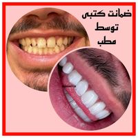 دندانپزشکی ترمیم کامپوزیت روکش دندان جراحی|خدمات آرایشگری و زیبایی|تهران, تهرانپارس غربی|دیوار