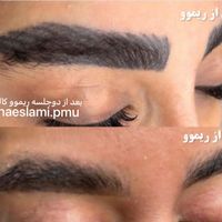 ریموو تخصصی گیاهی تتو قدیمی(سالاریه)|خدمات آرایشگری و زیبایی|قم, سالاریه|دیوار