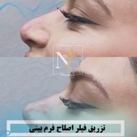 جشنواره یلدایی ژل،نخ،بوتاکس،فیلرلب ازسیصدهزارتومان|خدمات آرایشگری و زیبایی|تهران, نیاوران|دیوار