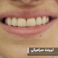 جشنواره خدمات دندانپزشکی به مدت محدود|خدمات آرایشگری و زیبایی|تهران, نارمک|دیوار