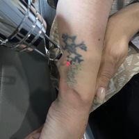 *پاک کردن تتو(تاتو)،خالکوبی کربن تراپی|خدمات آرایشگری و زیبایی|اصفهان, مرداویج|دیوار